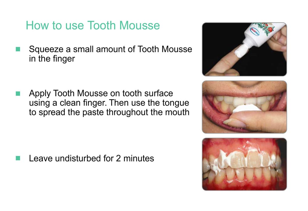 GC TOOTH MOUSSE